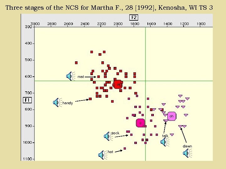 Three stages of the NCS for Martha F. , 28 [1992], Kenosha, WI TS