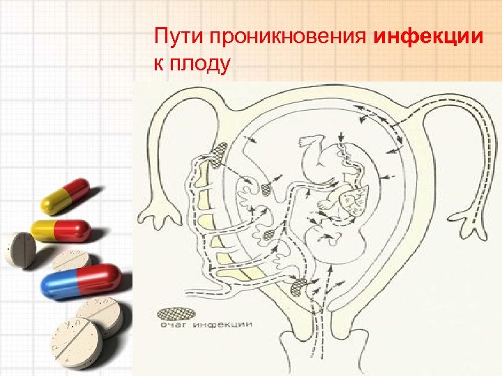 Пути проникновения инфекции к плоду 