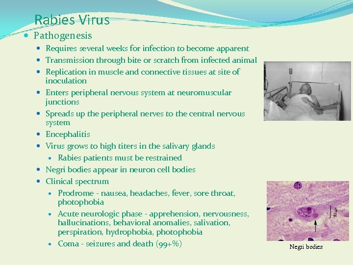 Rabies Virus Pathogenesis Requires several weeks for infection to become apparent Transmission through bite