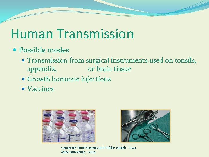 Human Transmission Possible modes Transmission from surgical instruments used on tonsils, appendix, or brain