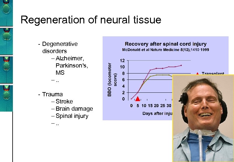Regeneration of neural tissue - Degenerative disorders – Alzheimer, Parkinson's, MS –. . -