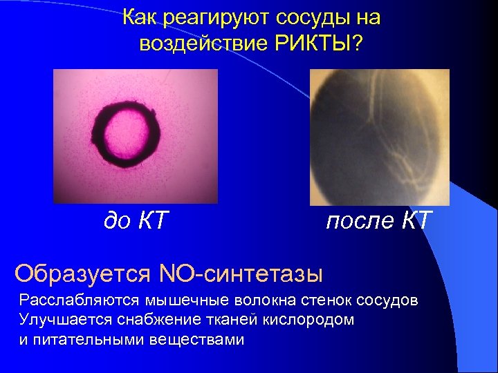 Как реагируют cосуды на воздействие РИКТЫ? до КТ после КТ Образуется NO-синтетазы Расслабляются мышечные