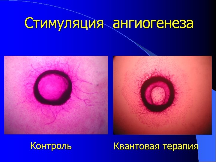 Стимуляция ангиогенеза Контроль Квантовая терапия 