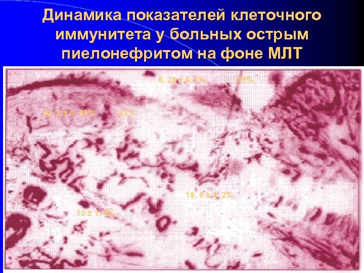 Динамика показателей клеточного иммунитета у больных острым пиелонефритом на фоне МЛТ 8, 28 ±