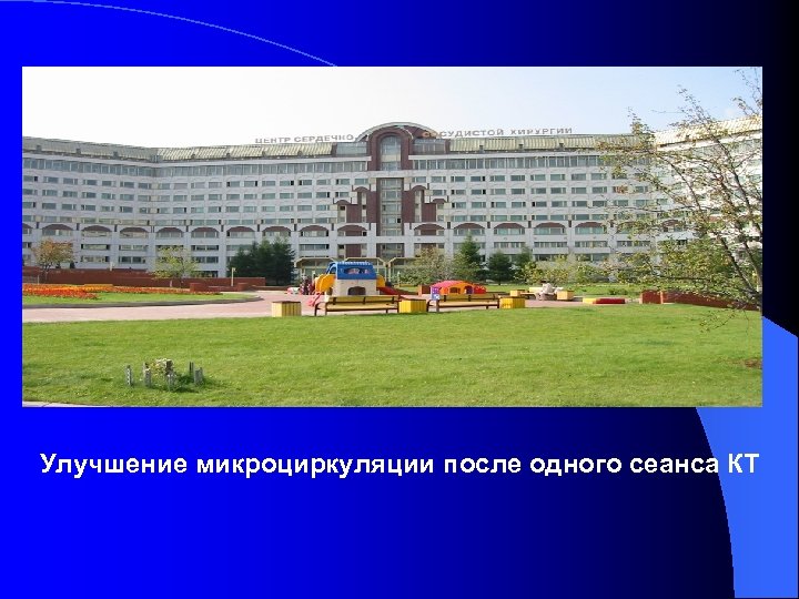 Улучшение микроциркуляции после одного сеанса КТ 