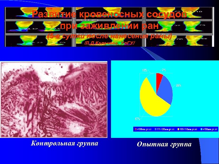 Развитие кровеносных сосудов при заживлении ран (5 -е сутки после нанесения раны) /Л. Д.