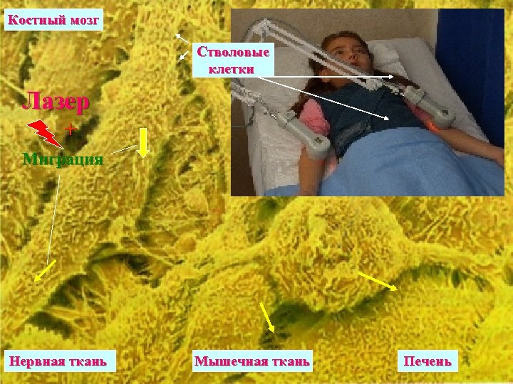 Костный мозг Стволовые клетки Лазер + Миграция Нервная ткань Мышечная ткань Печень 