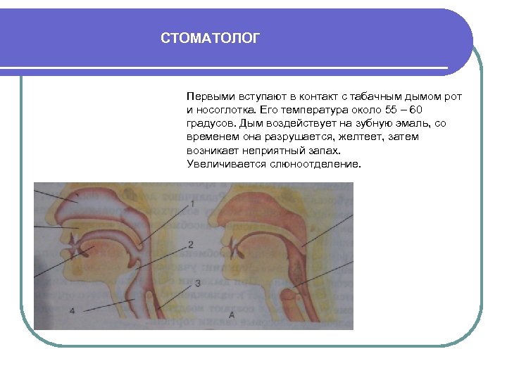 СТОМАТОЛОГ Первыми вступают в контакт с табачным дымом рот и носоглотка. Его температура около