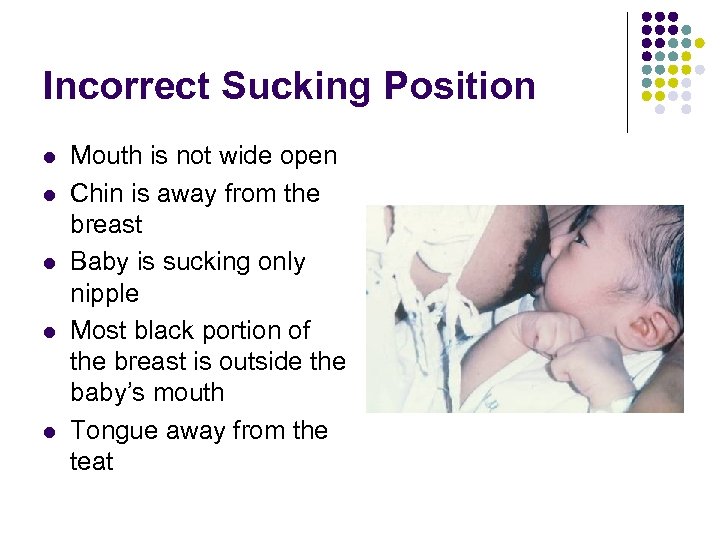 Incorrect Sucking Position l l l Mouth is not wide open Chin is away