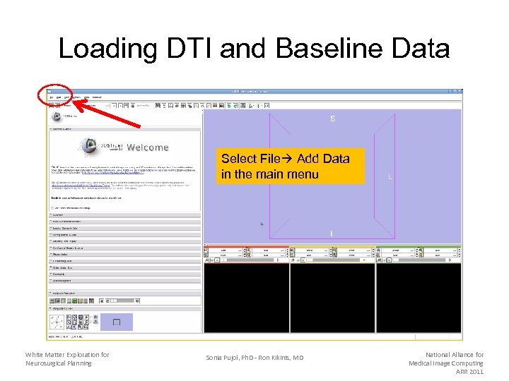 Loading DTI and Baseline Data Select File Add Data in the main menu White