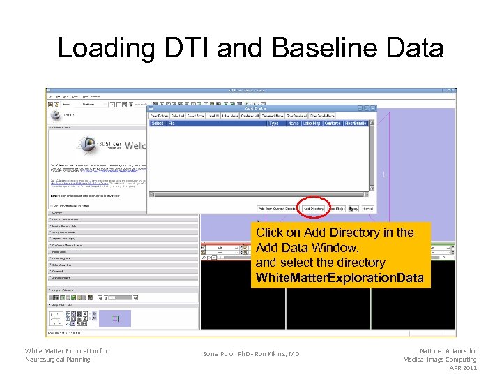 Loading DTI and Baseline Data Click on Add Directory in the Add Data Window,
