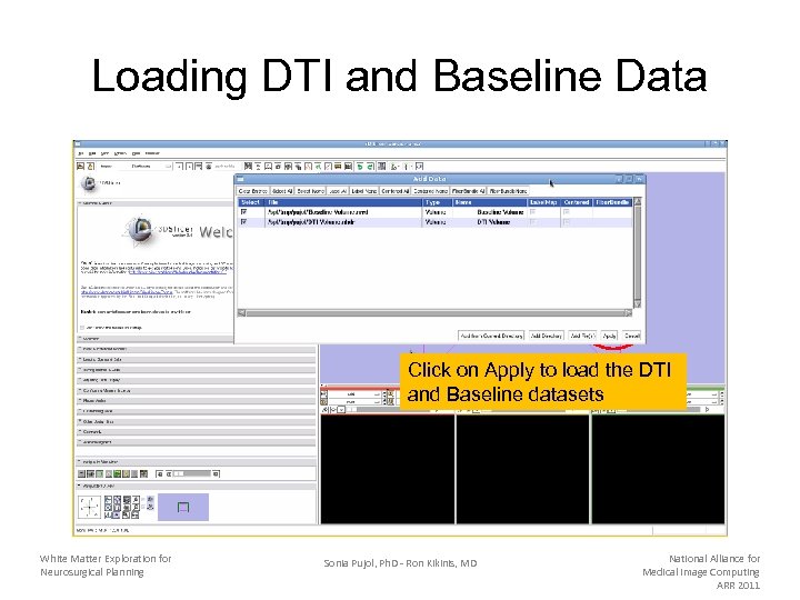 Loading DTI and Baseline Data Click on Apply to load the DTI and Baseline