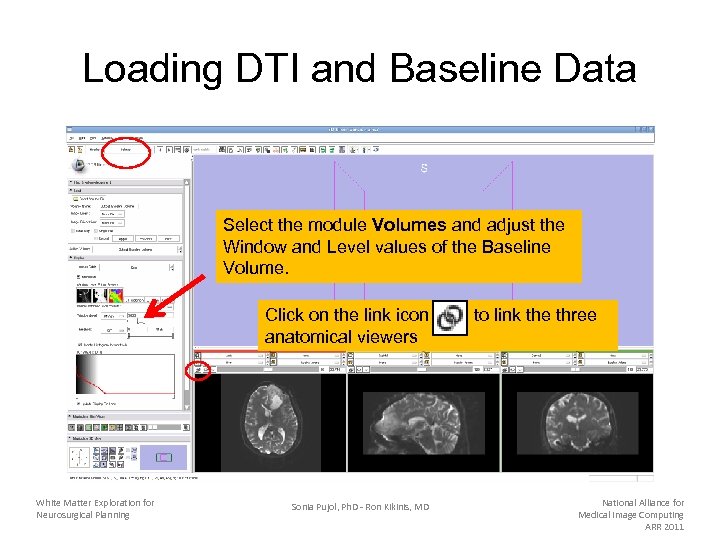Loading DTI and Baseline Data Select the module Volumes and adjust the Window and