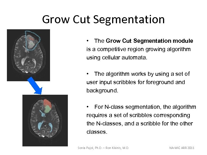 Grow Cut Segmentation • The Grow Cut Segmentation module is a competitive region growing