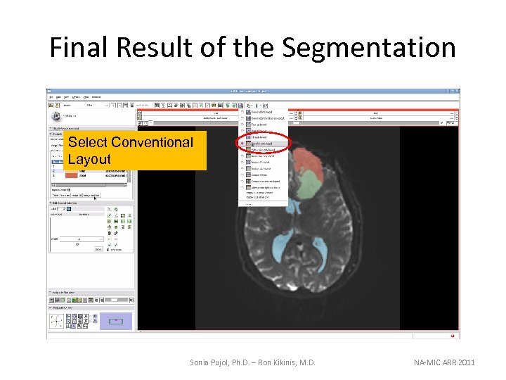 Final Result of the Segmentation Select Conventional Layout Sonia Pujol, Ph. D. – Ron