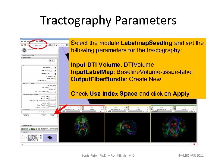 Tractography Parameters Select the module Labelmap. Seeding and set the following parameters for the