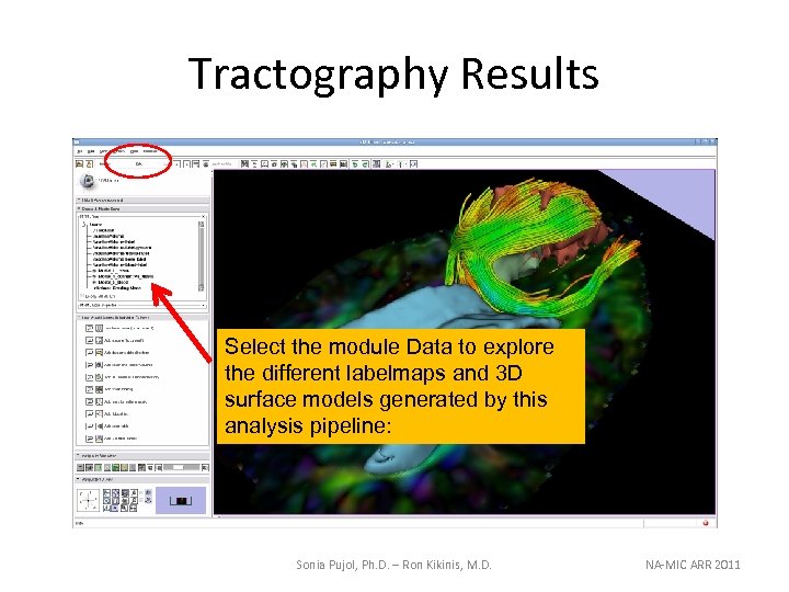Tractography Results Select the module Data to explore the different labelmaps and 3 D