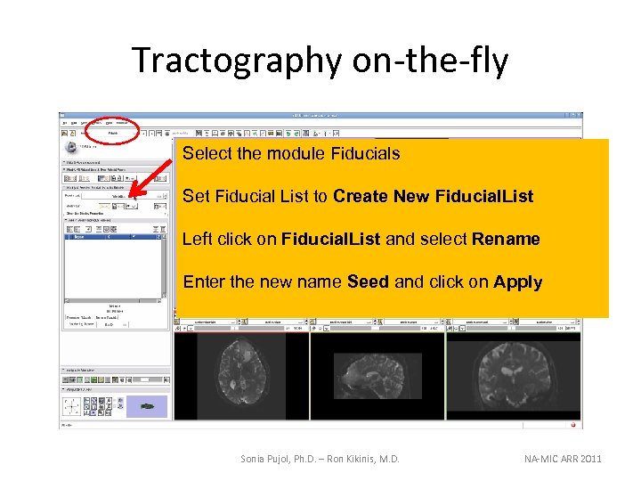 Tractography on-the-fly Select the module Fiducials Set Fiducial List to Create New Fiducial. List