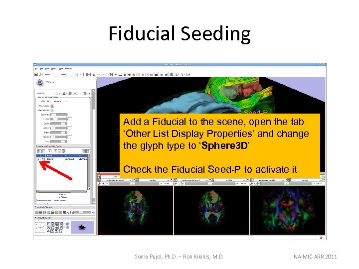 Fiducial Seeding Add a Fiducial to the scene, open the tab ‘Other List Display