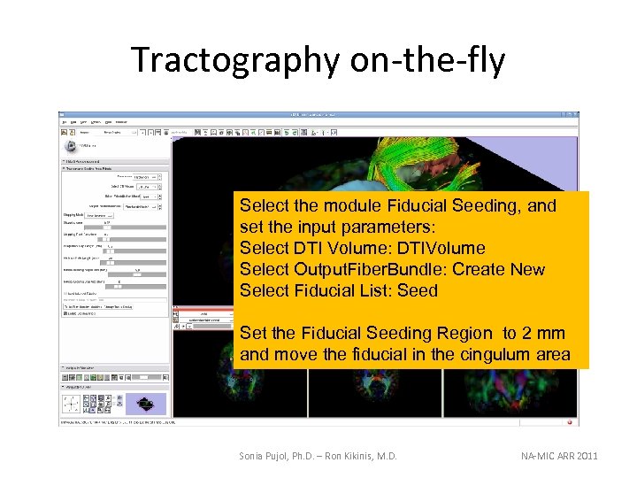 Tractography on-the-fly Select the module Fiducial Seeding, and set the input parameters: Select DTI