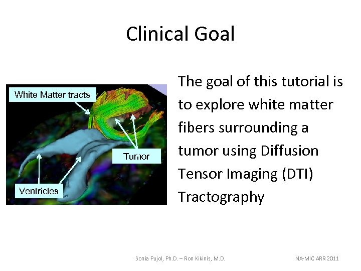 Clinical Goal White Matter tracts Tumor Ventricles The goal of this tutorial is to