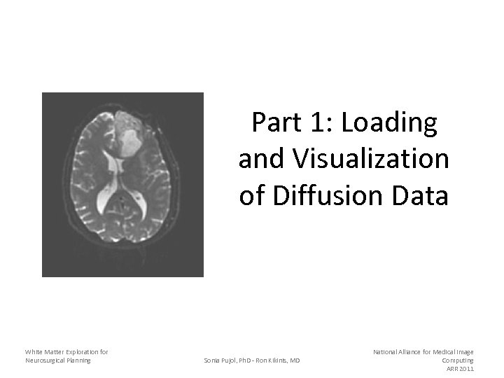 Part 1: Loading and Visualization of Diffusion Data White Matter Exploration for Neurosurgical Planning