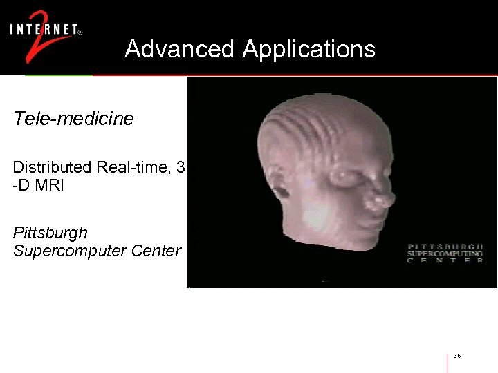 Advanced Applications Tele-medicine Distributed Real-time, 3 -D MRI Pittsburgh Supercomputer Center Images courtesy Univ.