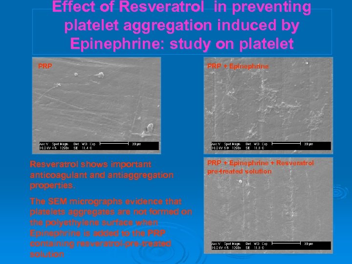 Effect of Resveratrol in preventing platelet aggregation induced by Epinephrine: study on platelet PRP