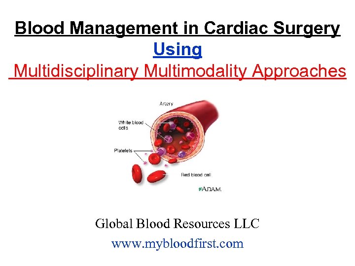 Blood Management in Cardiac Surgery Using Multidisciplinary Multimodality Approaches Global Blood Resources LLC www.