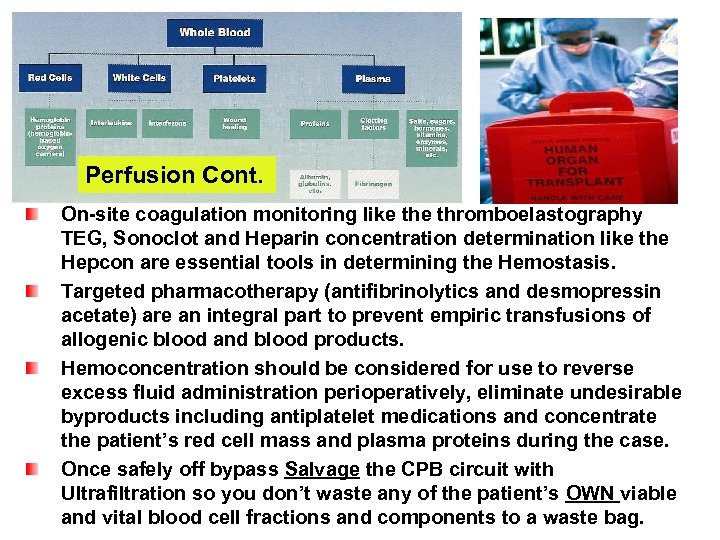 Perfusion Cont. On-site coagulation monitoring like thromboelastography TEG, Sonoclot and Heparin concentration determination like