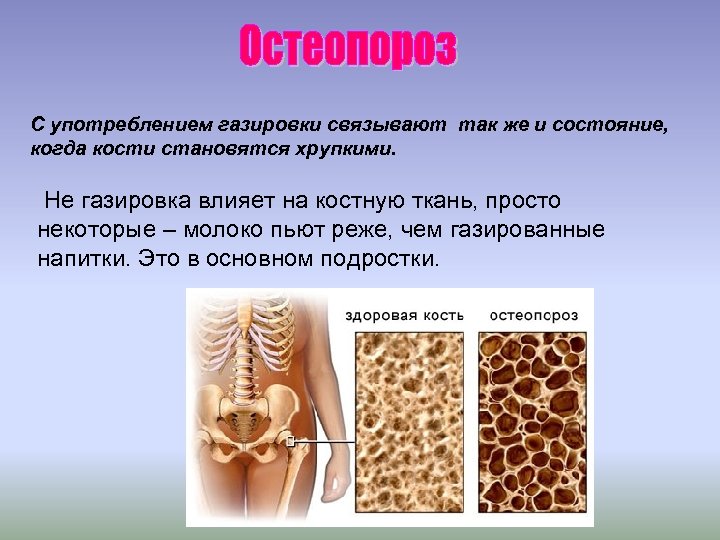 Стал на костях. Влияние газировки на организм человека. Влияние газированных напитков на организм человека. Влияние газировки на здоровье человека. Влияние газировки на организм человека кратко.