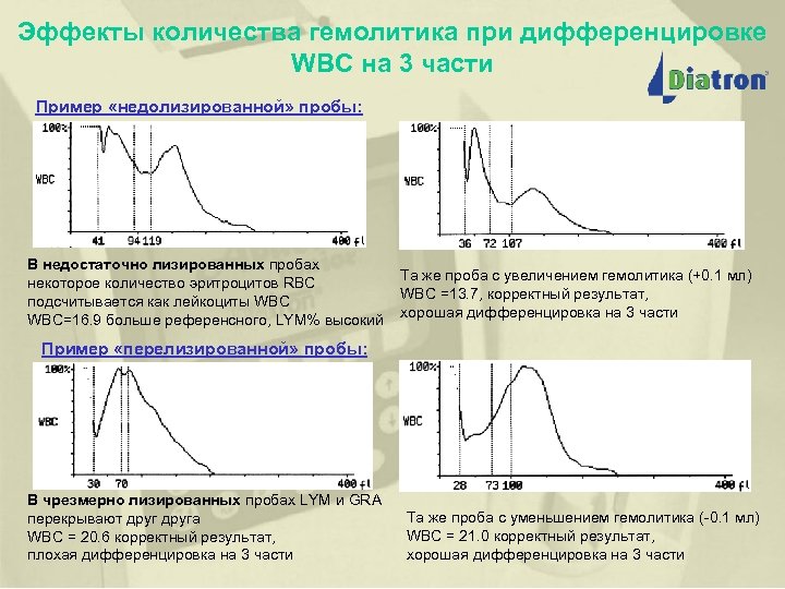 Эффекты количества гемолитика при дифференцировке WBC на 3 части Пример «недолизированной» пробы: (исследование по