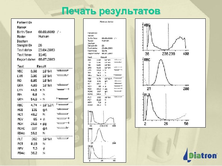 Печать результатов 