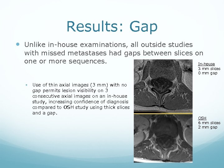 Results: Gap Unlike in-house examinations, all outside studies with missed metastases had gaps between