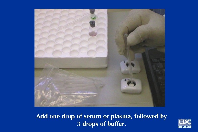 Add one drop of serum or plasma, followed by 3 drops of buffer. 