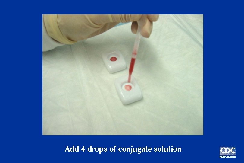 Add 4 drops of conjugate solution 