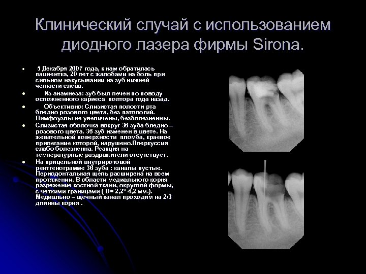 Клинический случай с использованием диодного лазера фирмы Sirona. l l l 5 Декабря 2007