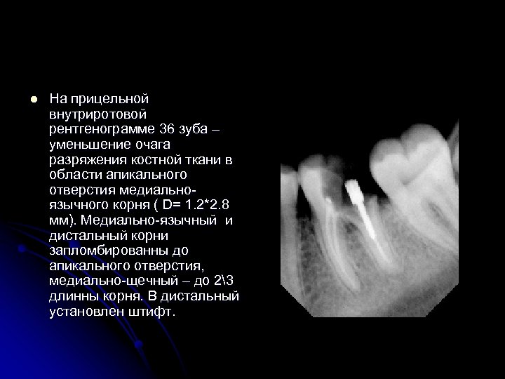 Рентгенография в стоматологии презентация