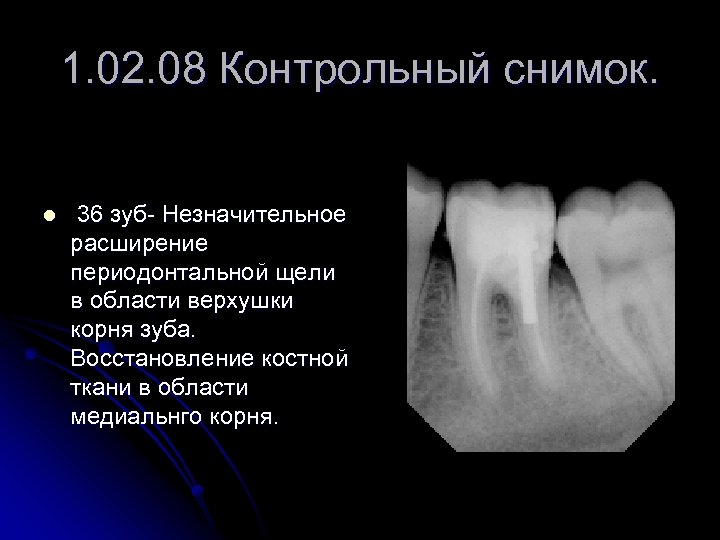 Описание рентген снимка зуба образец