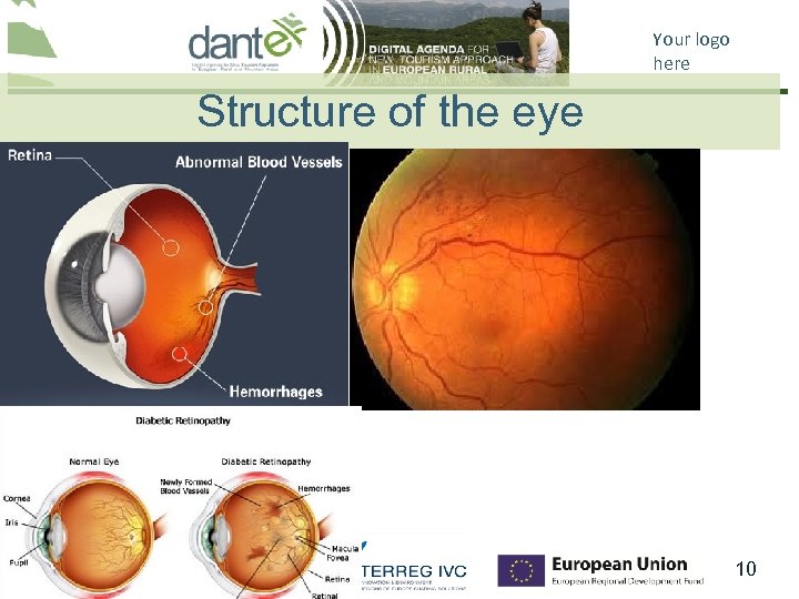 Your logo here Structure of the eye This project is co-financed by the ERDF