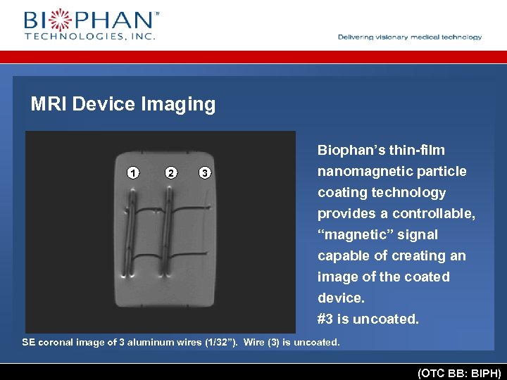 MRI Device Imaging 1 2 3 Biophan’s thin-film nanomagnetic particle coating technology provides a