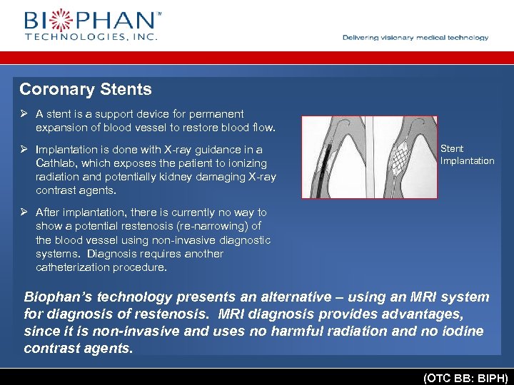Coronary Stents Ø A stent is a support device for permanent expansion of blood
