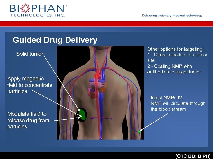 Guided Drug Delivery Solid tumor Other options for targeting: 1 - Direct injection into