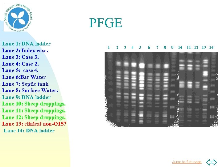 PFGE Lane 1: DNA ladder Lane 2: Index case. Lane 3: Case 3. Lane