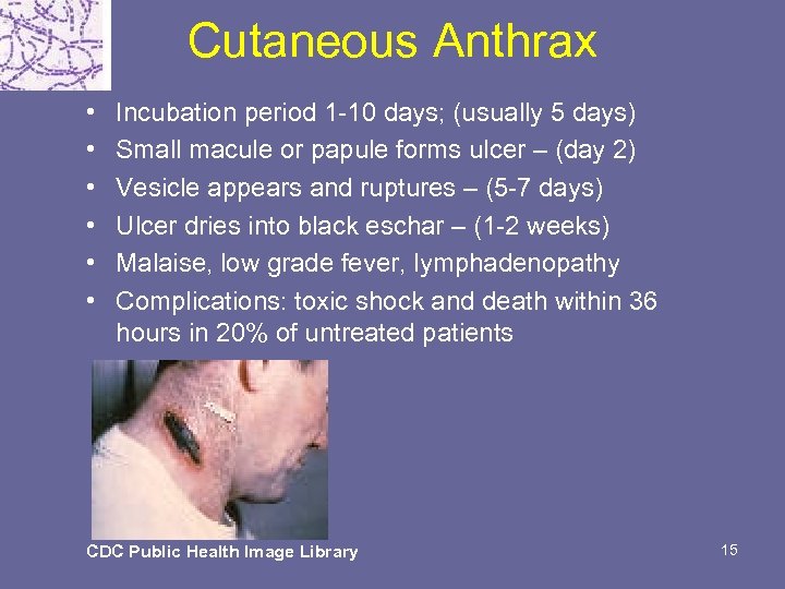 Cutaneous Anthrax • • • Incubation period 1 -10 days; (usually 5 days) Small