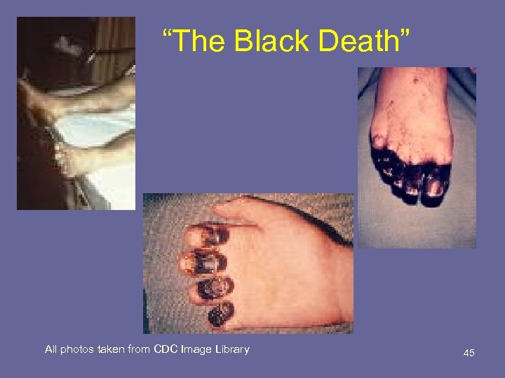 “The Black Death” All photos taken from CDC Image Library 45 