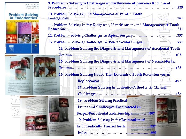 9. Problem - Solving in Challenges in the Revision of previous Root Canal Procedures…………………………………….