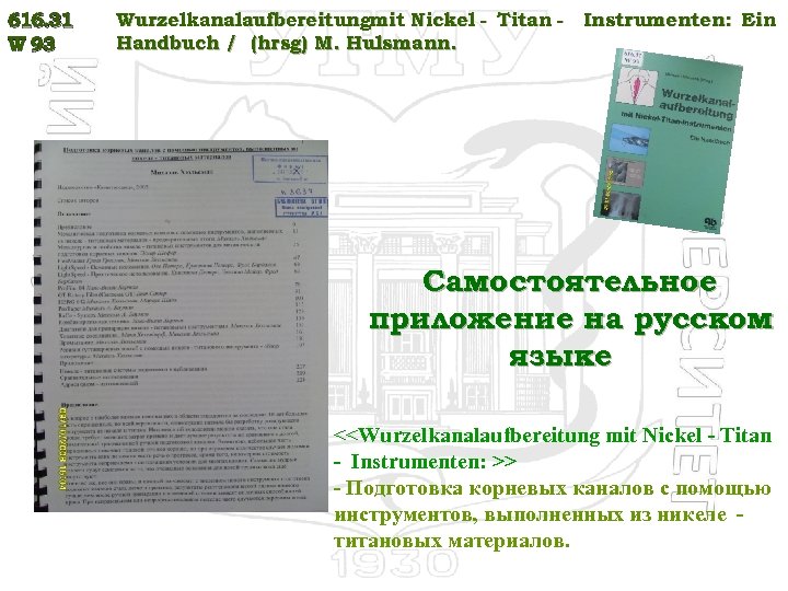 616. 31 W 93 Wurzelkanalaufbereitungmit Nickel - Titan - Instrumenten: Ein Handbuch / (hrsg)