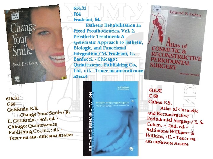 616. 31 F 84 Fradeani, M. Esthetic Rehabilitation in Fixed Prosthodontics. Vol. 2. Prosthetic