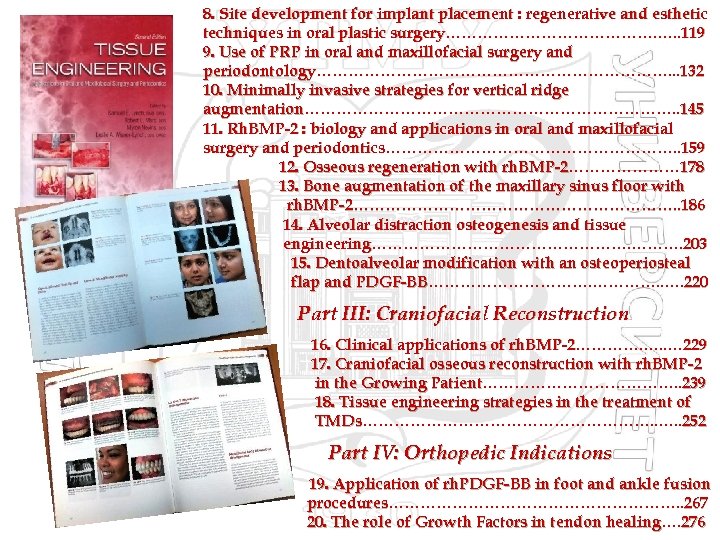 8. Site development for implant placement : regenerative and esthetic techniques in oral plastic